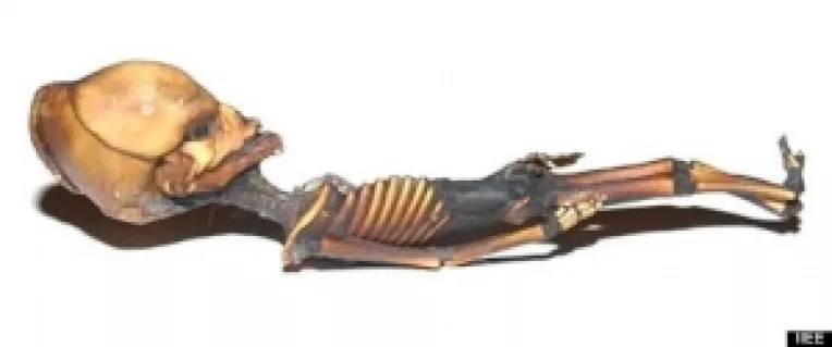 Testul ADN al foetusului extraterestrului din Sirius a dat rezultate ce nu pot fi clasate